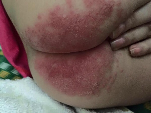 Tre-bi-ham-do-dung-bim-gia