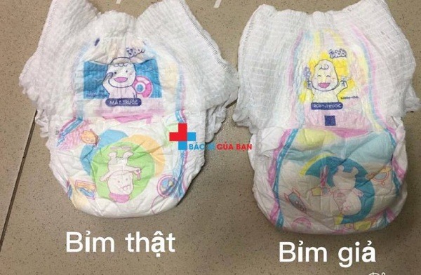 nhận biết qua chun bụng